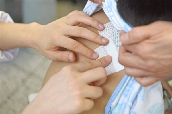 金股配资网 安徽淮南：入伏首日 冬病夏治